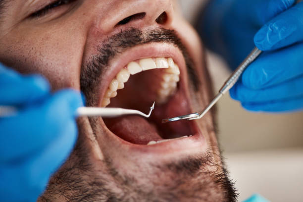 Best Emergency Dentist Open Today  in Baxter Springs, KS